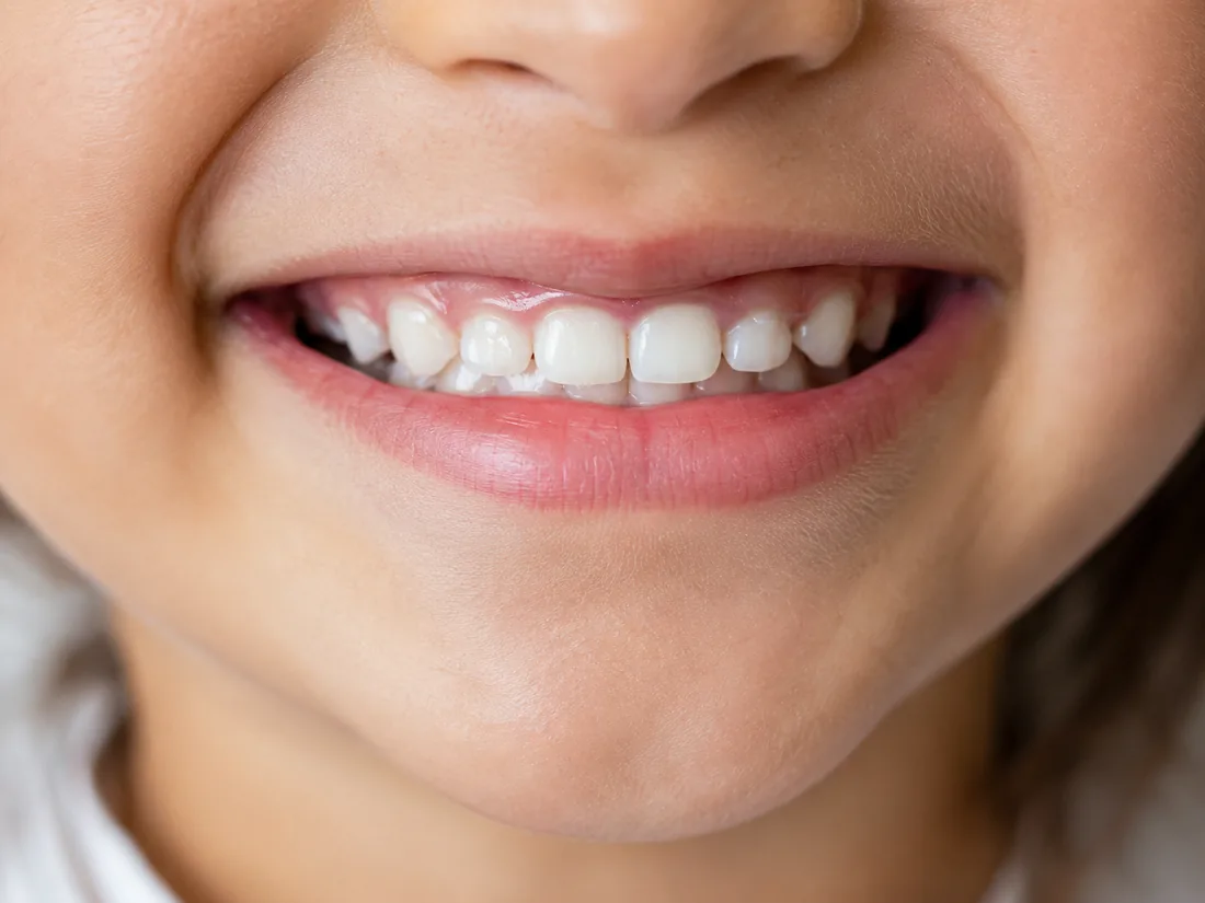 Close-up of a child's healthy, bright smile